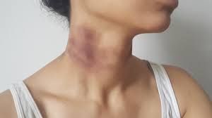 Panic Attack and Claustrophobia: The Common Internal Enemies in Bjj